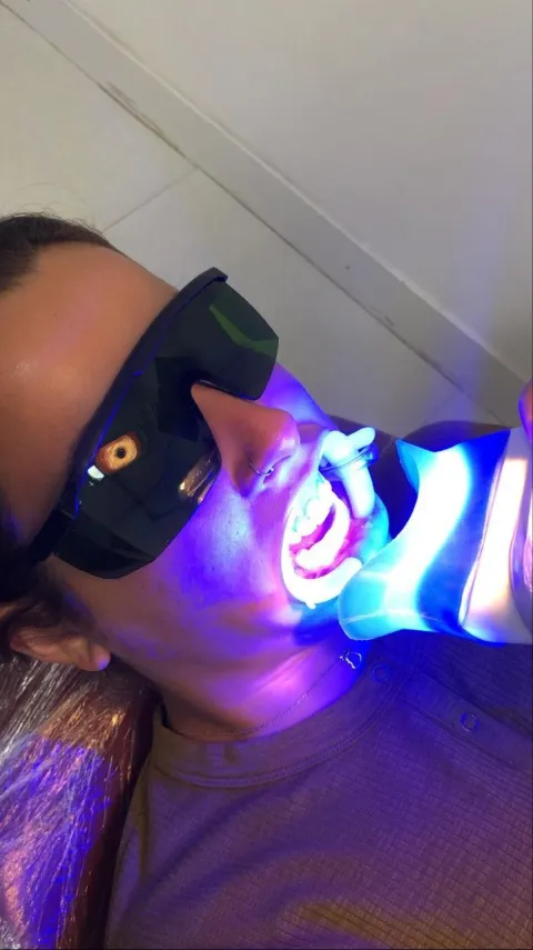Paciente durante clareamento dental com luz de LED